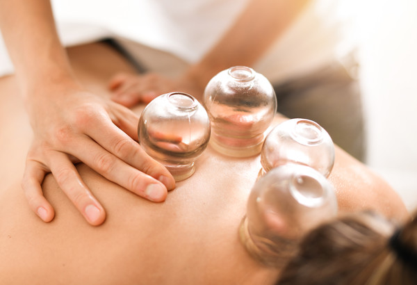 cupping therapy