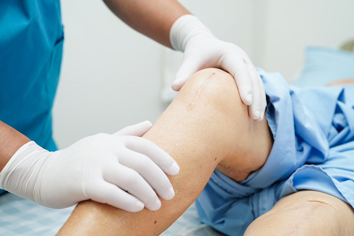 joint replacement trends 2025