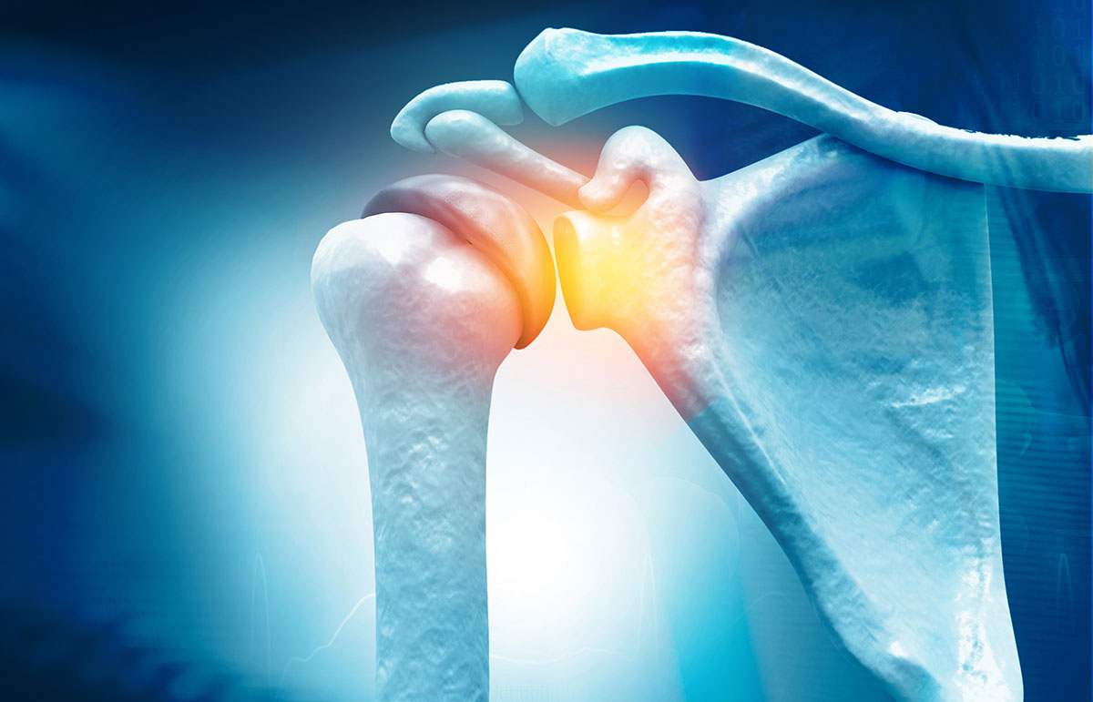 rotator cuff surgery